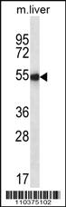 Anti-IHH Rabbit Polyclonal Antibody