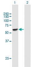 Anti-UGT2B15 Mouse Polyclonal Antibody