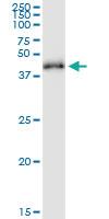 Anti-RRS1 Polyclonal Antibody Pair