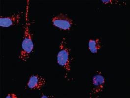 Anti-PTK2 + PTEN Antibody Pair