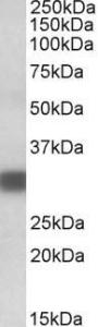 Anti-PDXP Antibody (A84897) (01 µg/ml) staining of Human Heart lysate (35 µg protein in RIPA buffer) Primary incubation was 1 hour Detected by chemiluminescence