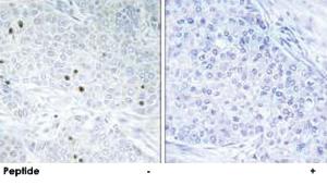 Anti-TP53INP2 Rabbit Polyclonal Antibody