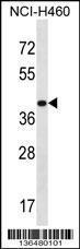 Anti-MRPS9 Rabbit Polyclonal Antibody (FITC (Fluorescein Isothiocyanate))