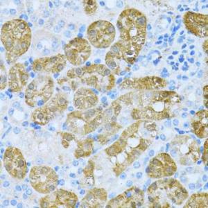 Anti-KLHL42 Rabbit Polyclonal Antibody