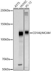 Anti-CD146 Rabbit Polyclonal Antibody