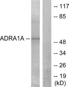 Western blot analysis of lysates from lOVO cells using Anti-ADRA1A Antibody. The right hand lane represents a negative control, where the antibody is blocked by the immunising peptide