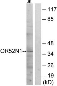 Western blot analysis of lysates from Jurkat cells using Anti-OR52N1 Antibody. The right hand lane represents a negative control, where the antibody is blocked by the immunising peptide