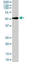 Anti-UGT2B15 Mouse Polyclonal Antibody