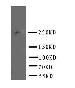 Anti-ABCA4 Rabbit Polyclonal Antibody