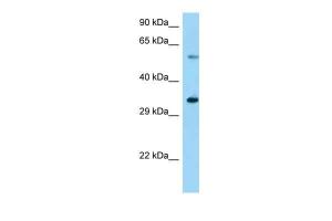 Anti-USP27X Rabbit Polyclonal Antibody