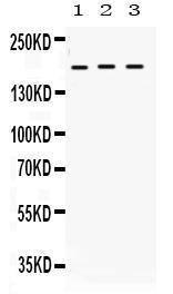 Anti-LIFR Rabbit Polyclonal Antibody