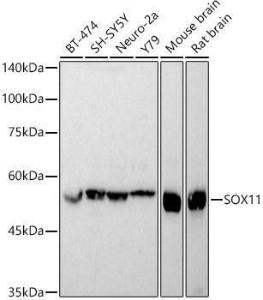 Anti-SOX11 antibody