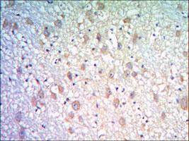 Anti-KLHL21 Mouse Monoclonal Antibody [clone: 2H4]