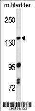 Anti-MAP3K5 Rabbit Polyclonal Antibody (AP (Alkaline Phosphatase))