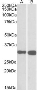 Anti-PDXP Antibody (A84897) (01 µg/ml) staining of Mouse (A) and Rat (B) Brain lysates (35 µg protein in RIPA buffer) Primary incubation was 1 hour Detected by chemiluminescence