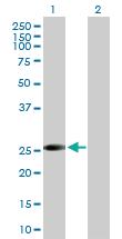 Anti-VAPB Mouse Polyclonal Antibody