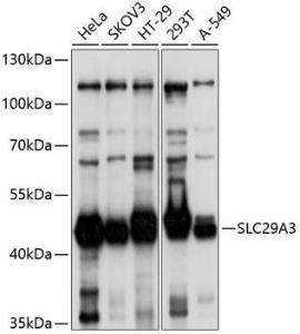 Western blot analysis of extracts of various cell lines, using Anti-SLC29A3 / ENT3 Antibody (A8600) at 1:1,000 dilution. The secondary antibody was Goat Anti-Rabbit IgG H&L Antibody (HRP) at 1:10,000 dilution. Lysates/proteins were present at 25µg per lane.