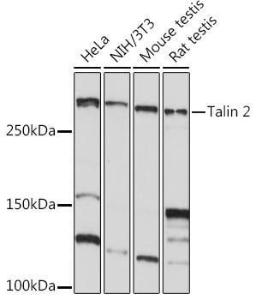 Western blot analysis of extracts of various cell lines, using Anti-Talin 2 Antibody [ARC2335] (A309077) at 1:1,000 dilution