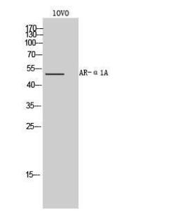 Western blot analysis of lOVO cells using Anti-ADRA1A Antibody