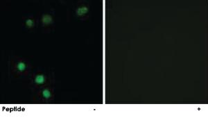 Anti-TP53INP2 Rabbit Polyclonal Antibody