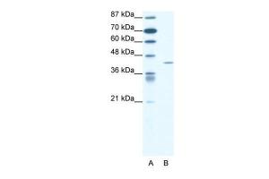 Anti-FOXL2 Rabbit Polyclonal Antibody