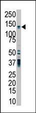 Anti-PRKD2 Rabbit Polyclonal Antibody (HRP (Horseradish Peroxidase))