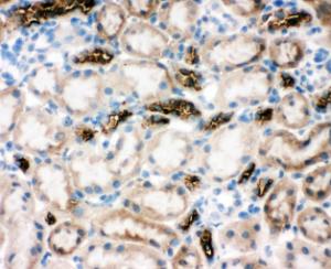 Anti-SLC12A1 Rabbit Polyclonal Antibody