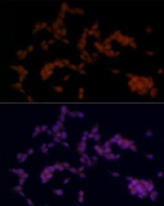 Anti-SOX11 antibody