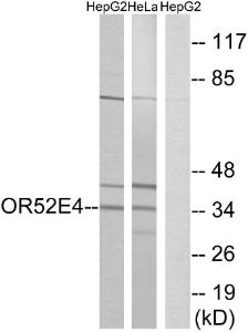 Anti-OR52E4 antibody