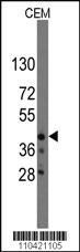 Anti-QKI Rabbit Polyclonal Antibody