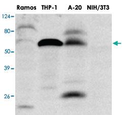 Anti-IRF5 Mouse Monoclonal Antibody [clone: 10T1]