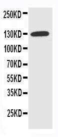 Anti-NKCC1 Rabbit Polyclonal Antibody