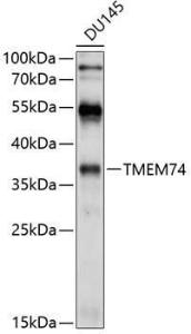 Western blot analysis of extracts of DU145 cells, using Anti-TMEM74 Antibody (A8602) at 1:1,000 dilution. The secondary antibody was Goat Anti-Rabbit IgG H&L Antibody (HRP) at 1:10,000 dilution. Lysates/proteins were present at 25µg per lane.