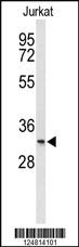 Anti-DSG3 Rabbit Polyclonal Antibody