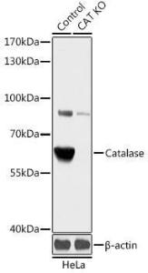 Western blot analysis of extracts from normal (control) and Catalasealase knockout (KO) HeLa cells, using Anti-Catalase Antibody (A92991) at 1:3000 dilution