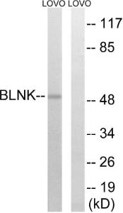 Western blot analysis of lysates from LOVO cells, treated with etoposide 25 µM 24 h using Anti-BLNK Antibody. The right hand lane represents a negative control, where the Antibody is blocked by the immunising peptide