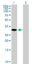 Anti-ZNF101 Mouse Polyclonal Antibody