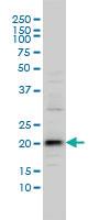 Anti-VSTM2L Mouse Monoclonal Antibody [clone: 3B9]