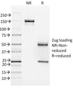 SDS-PAGE analysis of Anti-FOXA1 Antibody [FOXA1/1518] under non-reduced and reduced conditions; showing intact IgG and intact heavy and light chains, respectively. SDS-PAGE analysis confirms the integrity and purity of the Antibody