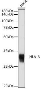 Western blot analysis of extracts of HeLa cells, using Anti-HLA-A Antibody (A306164) at 1:1,000 dilution. The secondary antibody was Goat Anti-Rabbit IgG H&L Antibody (HRP) at 1:10,000 dilution.