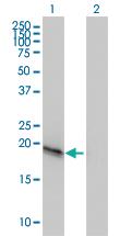 Anti-VSTM2L Mouse Monoclonal Antibody [clone: 3B9]