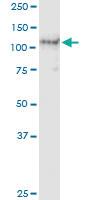 Anti-AXL Polyclonal Antibody Pair