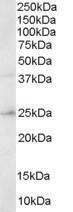 Anti-HSD17B10 Antibody (A83283) staining (0.3 µg/ml) of Human Brain lysate (RIPA buffer, 30 µg total protein per lane). Primary incubated for 1 hour. Detected by western blot using chemiluminescence