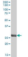 Anti-VAPB Mouse Polyclonal Antibody