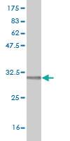 Anti-RCE1 Mouse Monoclonal Antibody [clone: 6A6]