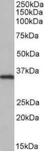 Anti-NEK7 antibody