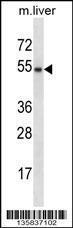 Anti-GATA3 Rabbit Polyclonal Antibody (AP (Alkaline Phosphatase))