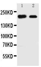 Anti-Tuberin Rabbit Polyclonal Antibody