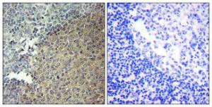 Immunohistochemical analysis of paraffin-embedded human tonsil tissue using Anti-BLNK Antibody. The right hand panel represents a negative control, where the Antibody was pre-incubated with the immunising peptide