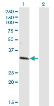 Anti-ZNF101 Mouse Monoclonal Antibody [clone: 2D5]